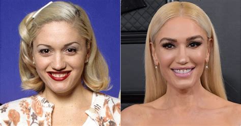 Did Gwen Stefani Have Plastic Surgery? Exploring the Evolution of a Pop Icon's Appearance